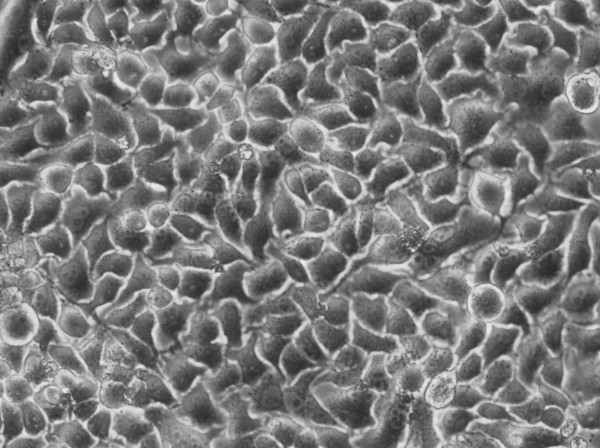 NS3-CMPK-hLBR1TM-mEGFP Cells