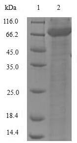 L-dopachrome tautomerase (Dct), partial, mouse, recombinant