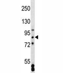 Anti-SATB2