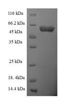 Scavenger receptor class B member 1 (SCARB1), partial, human, recombinant