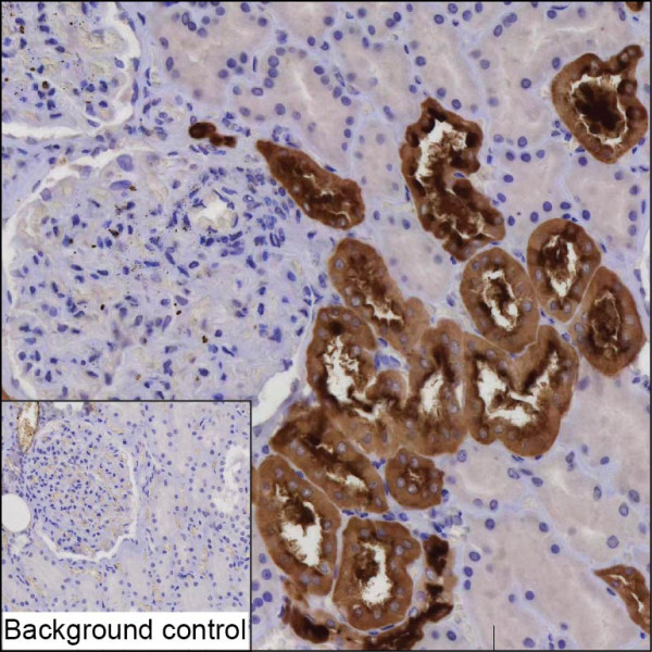 Anti-ATP6V1B1
