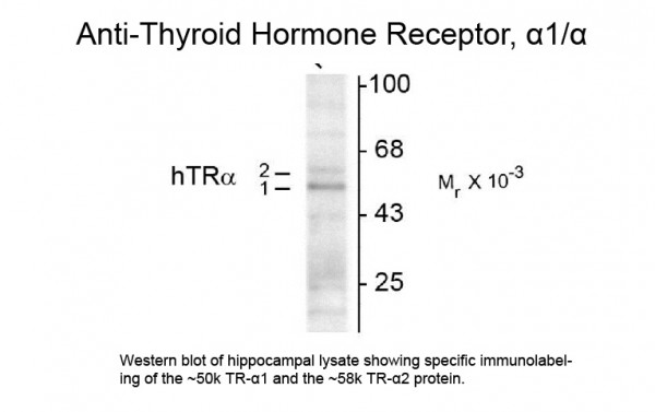 Anti-Thyroid Hormone Receptor alpha 1/2, clone 2103