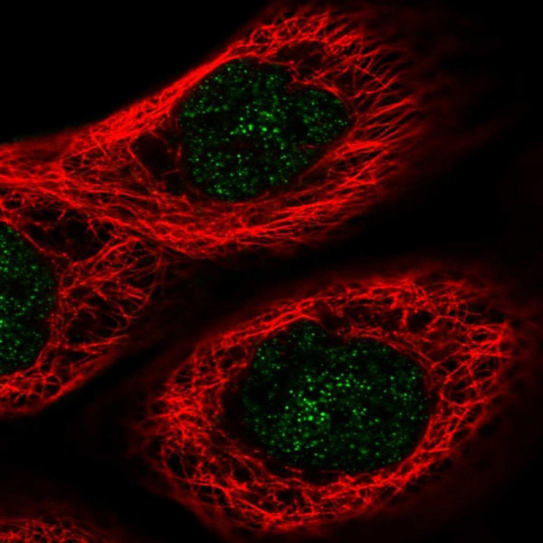 Anti-FHL3