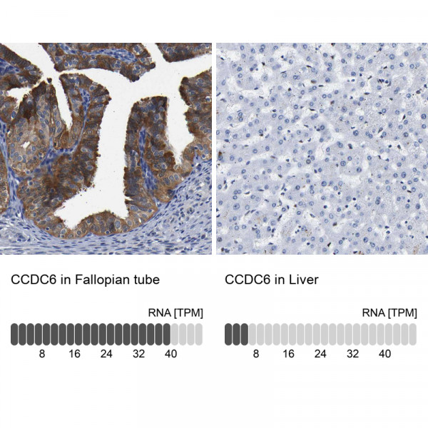 Anti-CCDC6