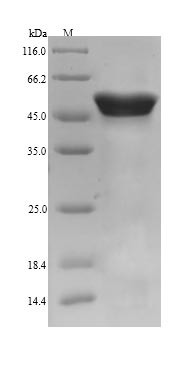 Calreticulin (CALR), swine, recombinant