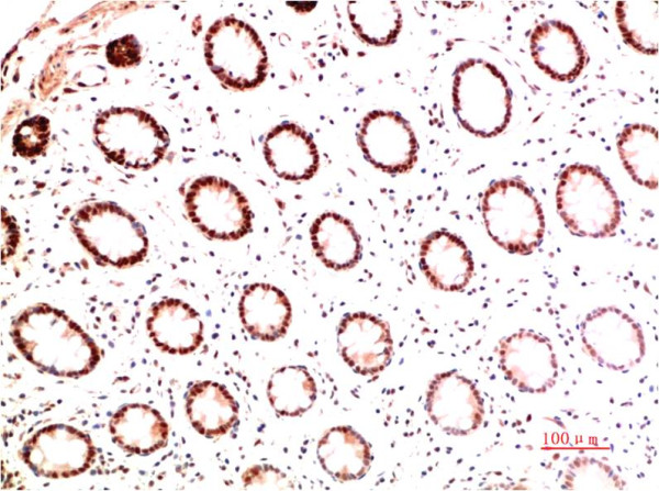 Anti-COL1A1