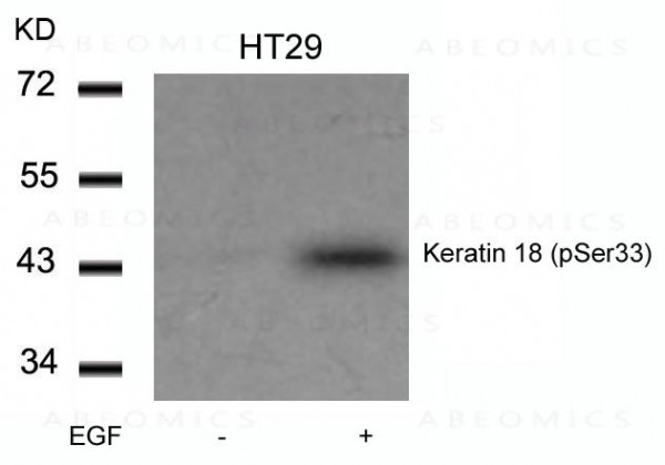 Anti-phospho-Keratin 18 (Ser33)