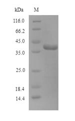 N-glycosylase/DNA lyase (OGG1), human, recombinant