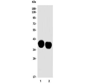 Anti-Mt-nd2 / NADH2