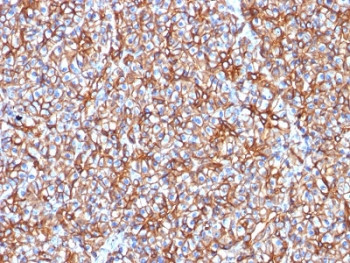 Anti-SPTBN2 / Spectrin beta III, clone SPTBN2/1778