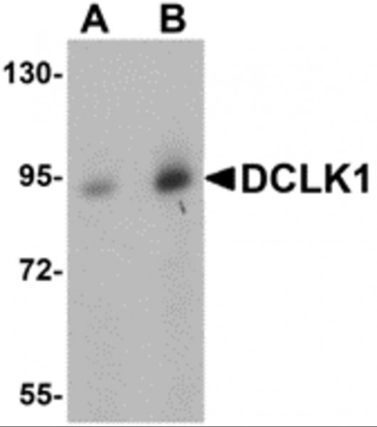 Anti-DCLK1