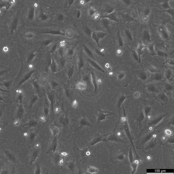 SNU-387 Cells