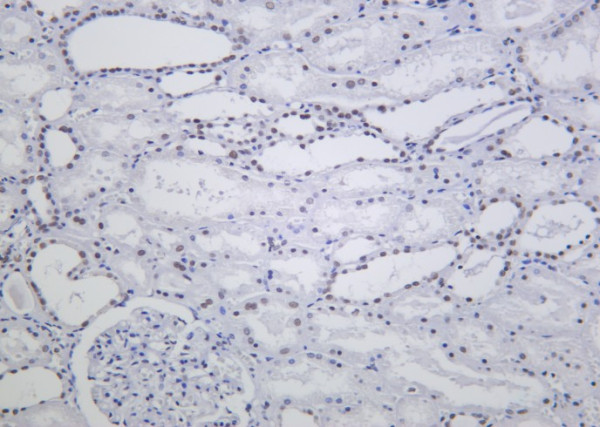 Anti-Recombinant ARID1A, clone 5H13