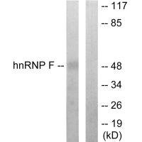 Anti-HNRNPF