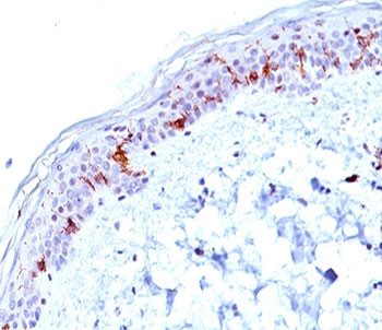 Anti-CD1a, clone O10