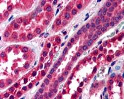 Anti-Amisyn / STXBP6, N-terminal