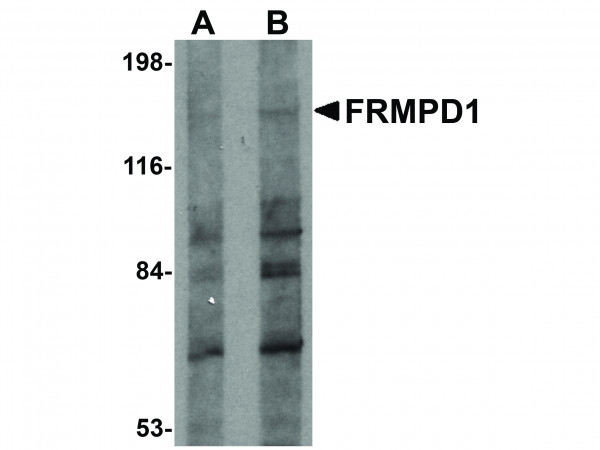Anti-FRMPD1