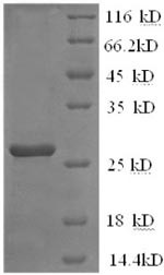Interleukin-2 receptor subunit beta (Il2rb), partial, mouse, recombinant