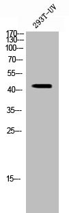 Anti-SIRT2