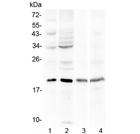 Anti-Myoglobin (N-Terminal Region)