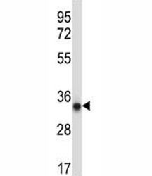 Anti-AMPK beta 2 / PRKAB2