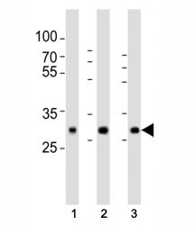 Anti-Superoxide Dismutase 3 Antibody (SOD3)