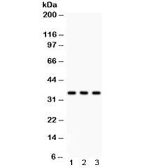 Anti-Caspase-7