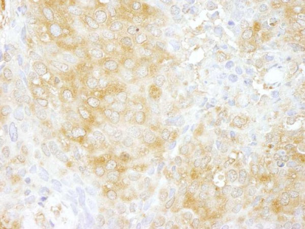 Anti-Cdc42GAP (IHC)