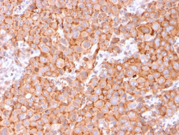 Anti-Uroplakin 1B / UPK1B, clone UPK1B/3081