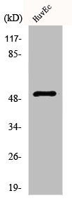 Anti-ALDH3B1