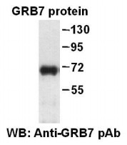 Anti-GRB7