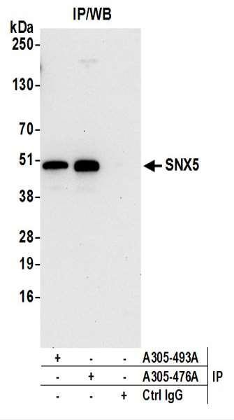 Anti-SNX5