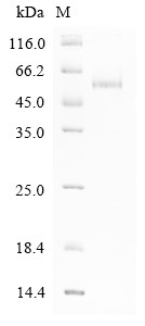 Histone-lysine N-methyltransferase SMYD3 (SMYD3), human, recombinant