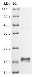 T-cell surface glycoprotein CD3 gamma chain (CD3G), partial, human, recombinant