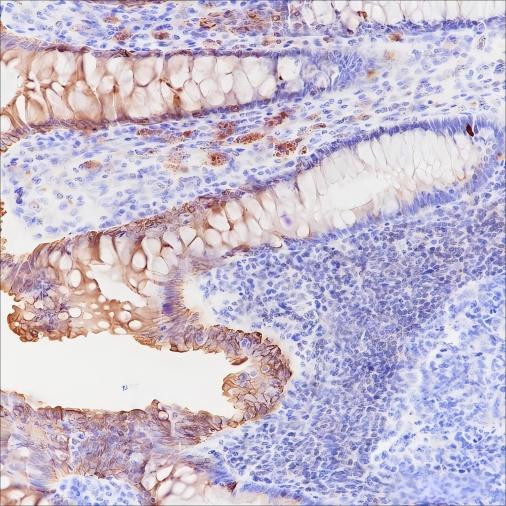 Anti-Recombinant c-erbB-3/HER-3, clone A215