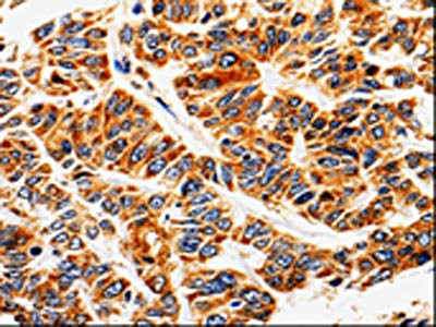 Anti-ABCB5