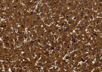 Anti-bFGF/FGF2 Monoclonal Recombinant Antibody