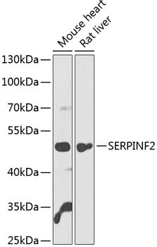 Anti-SERPINF2
