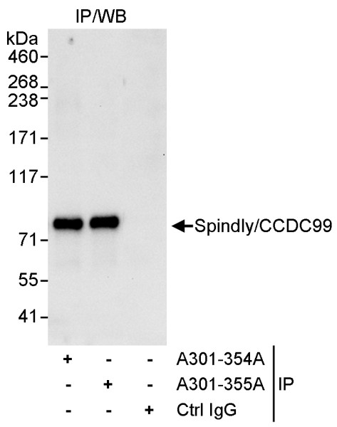 Anti-SPINDLY/CCDC99