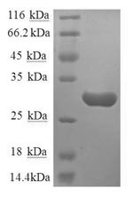 Substance-P receptor (TACR1), partial, human, recombinant