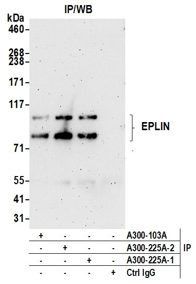 Anti-EPLIN