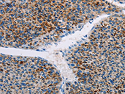 Anti-AMOTL2