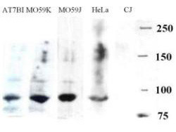 Anti-Artemis (DCLRE1C, DNA Cross-link Repair 1C)