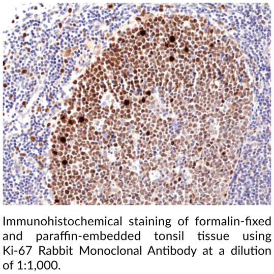 Anti-Ki-67 Rabbit Monoclonal Antibody (Clone RM360)