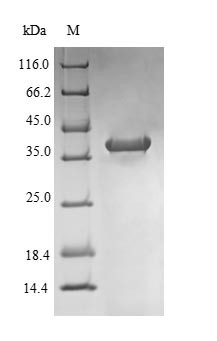 NADPH oxidase 4 (Nox4), partial, rat, recombinant