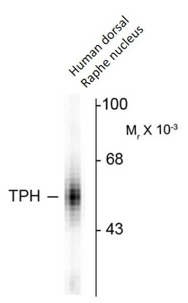 Anti-TPH1