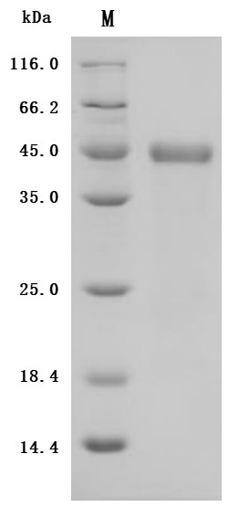 Zinc transporter ZIP6 isoform X1(SLC39A6),partial (Active), Macaca fascicularis, recombinant