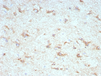 Anti-KChIP2 / KCNIP2, clone KCNIP2/7589