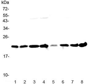 Anti-GLO1 / Glyoxalase I