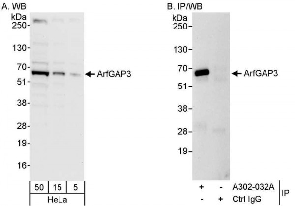 Anti-ArfGAP3